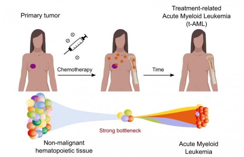 9  best types of cancer treatment