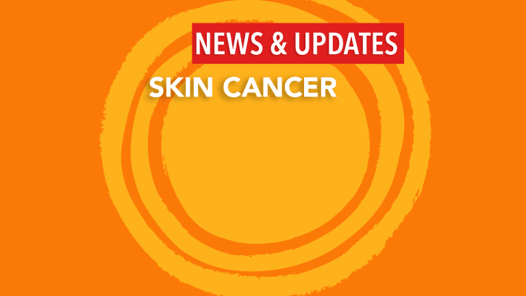 Skin cancer treatment options its Side effect & Prevention 2024