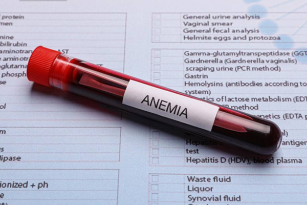 Anemia Basic symptoms 2024