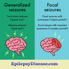 4 types of seizure severe symptoms