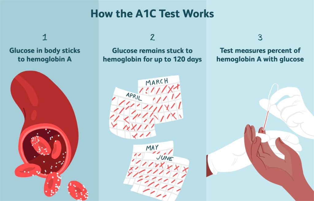 who diabetes diagnosis easily & best treatment criteria 2024