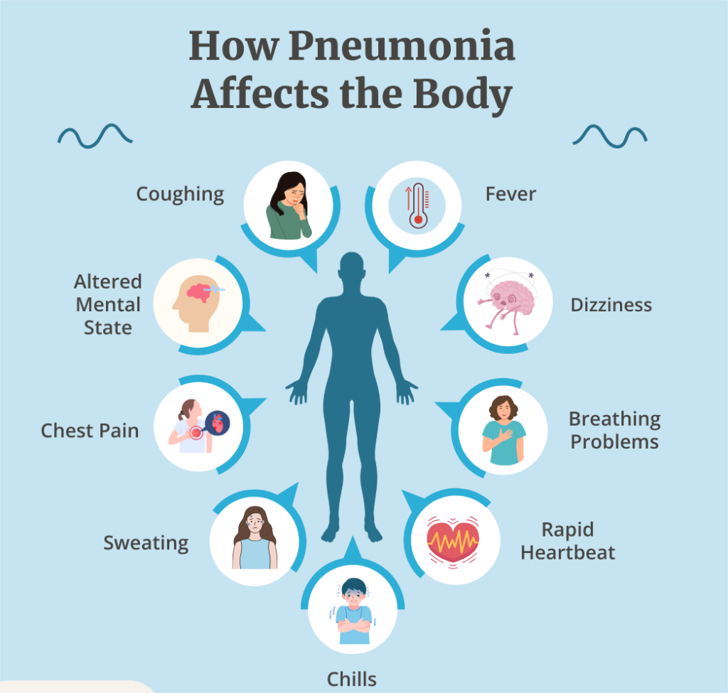 pneumonia symptoms basic 2024