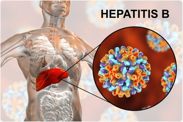 hepatitis B 4 Clear causes & symptoms