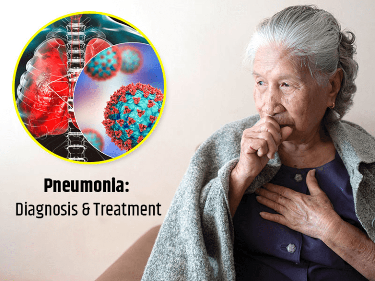 pneumonia diagnosis and best treatment 2024