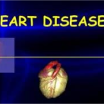 treatment for congestive heart disease & 8 Tests