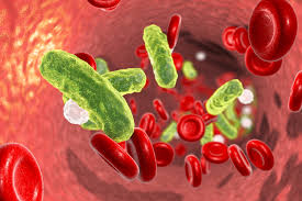 Sepsis basis symptoms, causes and 3 main stages